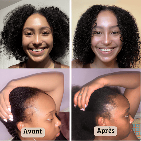 Huile De Batana Pure - N°1 pour cheveux afro