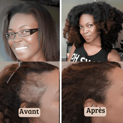 Huile De Batana Pure - N°1 pour cheveux afro