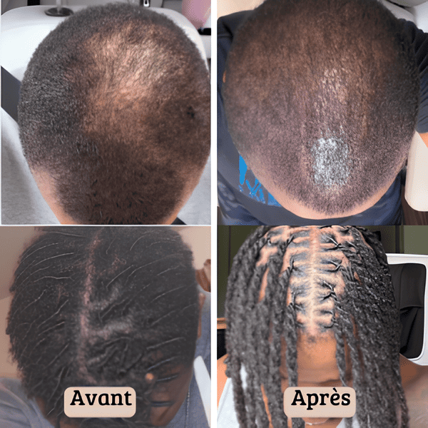 Huile De Batana Pure - N°1 pour cheveux afro